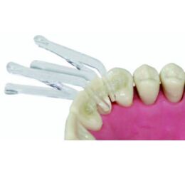 Clip & Splint aplikační svorky, 30ks