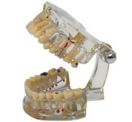 Model chrupu Transparent Plus