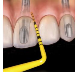 Colorvue Kit #12, 12 tips + 2 handles PH6, 3-6-9-1