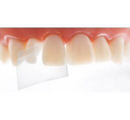 ProxyPal 3D Anterior Matrix