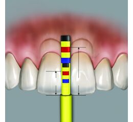 Chu Gauges PAPILLA refill tips 3pcs./pack.