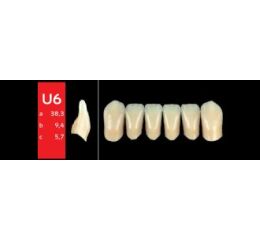 Ref-Line Anterior B1 U6 zuby