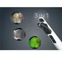 DIAGNOcam Vision Full HD