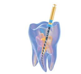 SUPER FILES III 25mm, sortiment SX-F3, 6ks