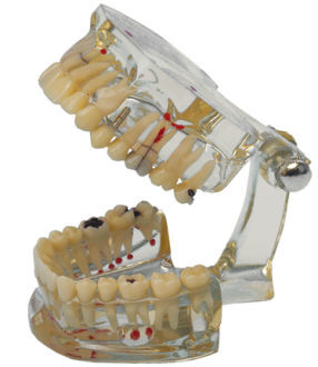 Model chrupu Transparent Plus