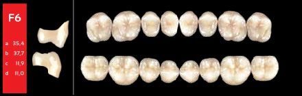 Ref-Line Posterior BL1 F6 dolní zuby