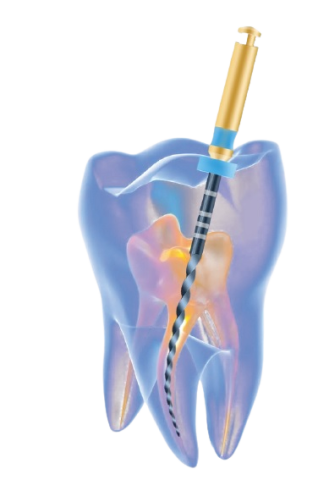 SUPER FILES II 25mm, X1-X3 sort., 6ks