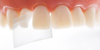 ProxyPal 3D Anterior Matrix