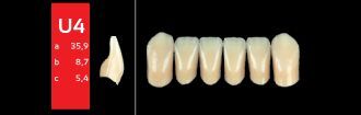 Ref-Line Anterior A4 U4 zuby