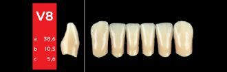 Ref-Line Anterior A1 V8 zuby