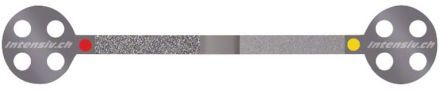 ProxoStrips Anterior 40/15µm