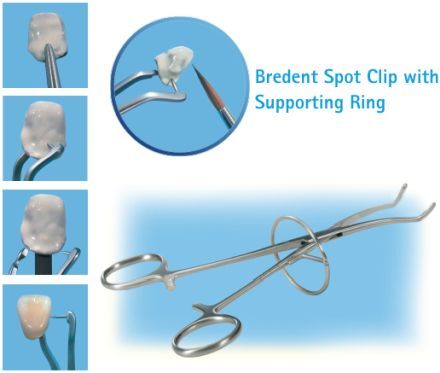 Spot Clip with Supporting Ring