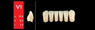 Ref-Line Anterior B1 V1 zuby