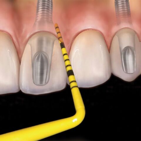 Colorvue Kit #11, 7 tips + 1 handle PH6, 3-6-8-11