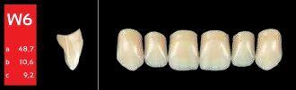 Ref-Line Anterior A1 W6 zuby