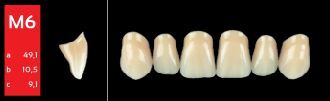 Ref-Line Anterior C1 M6 zuby