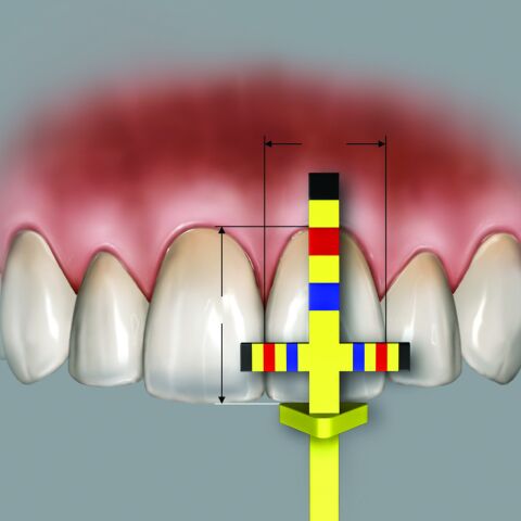 Chu Gauges T-BAR refill tips 3pcs./pack.