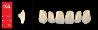 Ref-Line Anterior B1 K4 zuby