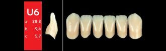 Ref-Line Anterior B2 U6 zuby