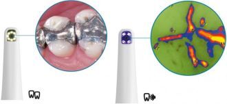 VistaCam iX Cam + Proof