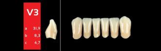 Ref-Line Anterior A3 V3 zuby