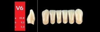 Ref-Line Anterior A1 V6 zuby