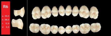 Ref-Line Posterior A2 R6 dolní zuby